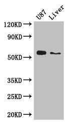 Immunofluorescent analysis of PC-3 cells using CAC08120 at dilution of 1:100 and Alexa Fluor 488-congugated AffiniPure Goat Anti-Rabbit IgG(H+L)