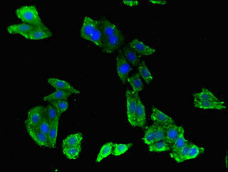 Abcb9 Polyclonal Antibody - image 3
