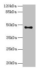 Aadacl2 Polyclonal Antibody - image 2