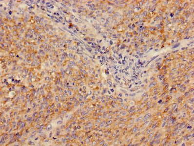 Immunofluorescence staining of U251 cells with CAC08209 at 1:160,counter-stained with DAPI. The cells were fixed in 4% formaldehyde, permeabilized using 0.2% Triton X-100 and blocked in 10% normal Goat Serum. The cells were then incubated with the antibody overnight at 4°C.The secondary antibody was Alexa Fluor 488-congugated AffiniPure Goat Anti-Rabbit IgG (H+L).