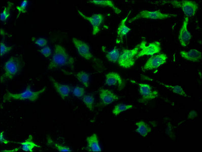 Ada Polyclonal Antibody - image 5