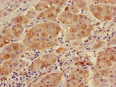 Immunofluorescence staining of HepG2 cells with CAC08211 at 1:166, counter-stained with DAPI. The cells were fixed in 4% formaldehyde, permeabilized using 0.2% Triton X-100 and blocked in 10% normal Goat Serum. The cells were then incubated with the antibody overnight at 4°C. The secondary antibody was Alexa Fluor 488-congugated AffiniPure Goat Anti-Rabbit IgG(H+L).