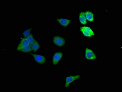 Adh1B Polyclonal Antibody - image 5