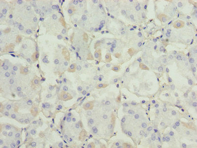Immunofluorescence staining of HepG2 cells with CAC08213 at 1:133,counter-stained with DAPI. The cells were fixed in 4% formaldehyde, permeabilized using 0.2% Triton X-100 and blocked in 10% normal Goat Serum. The cells were then incubated with the antibody overnight at 4°C.The secondary antibody was Alexa Fluor 488-congugated AffiniPure Goat Anti-Rabbit IgG (H+L).
