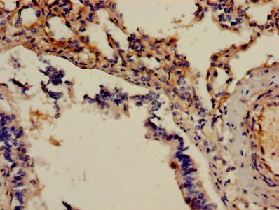 Immunohistochemistry of paraffin-embedded human kidney tissue using CAC08214 at dilution of 1:100