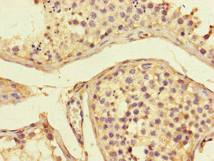 Immunohistochemistry of paraffin-embedded human placenta tissue using CAC08215 at dilution of 1:100