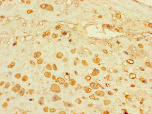 Immunofluorescent analysis of MCF-7 cells using CAC08215 at dilution of 1:100 and Alexa Fluor 488-congugated AffiniPure Goat Anti-Rabbit IgG(H+L)