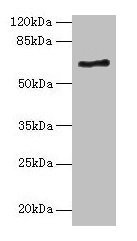 Immunohistochemistry of paraffin-embedded human liver tissue using CAC08222 at dilution of 1:100