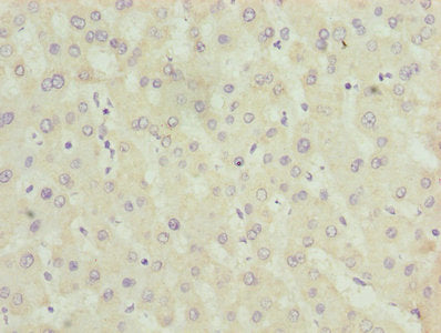 Immunohistochemistry of paraffin-embedded human thyroid tissue using CAC08222 at dilution of 1:100