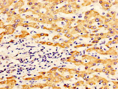Immunofluorescence staining of HepG2 cells with CAC08224 at 1:133, counter-stained with DAPI. The cells were fixed in 4% formaldehyde, permeabilized using 0.2% Triton X-100 and blocked in 10% normal Goat Serum. The cells were then incubated with the antibody overnight at 4°C. The secondary antibody was Alexa Fluor 488-congugated AffiniPure Goat Anti-Rabbit IgG(H+L).