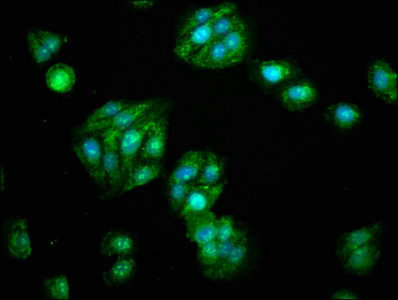 Aldh5A1 Polyclonal Antibody - image 5