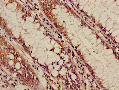 Immunofluorescence staining of Hela cells with CAC08226 at 1:110,counter-stained with DAPI. The cells were fixed in 4% formaldehyde, permeabilized using 0.2% Triton X-100 and blocked in 10% normal Goat Serum. The cells were then incubated with the antibody overnight at 4°C.The secondary antibody was Alexa Fluor 488-congugated AffiniPure Goat Anti-Rabbit IgG (H+L).
