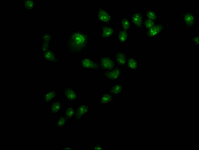 Alox5 Polyclonal Antibody - image 3