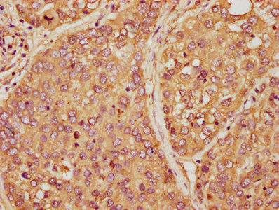 Ambp Polyclonal Antibody - image 3