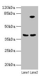 Immunohistochemistry of paraffin-embedded human thyroid tissue using CAC08232 at dilution of 1:100