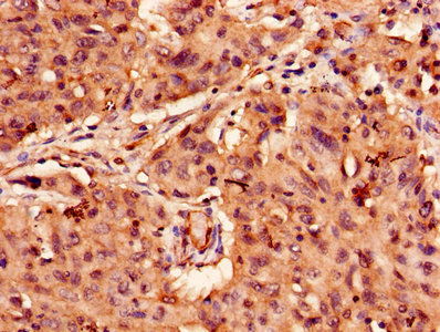 Immunofluorescence staining of A549 cells with CAC08235 at 1:166, counter-stained with DAPI. The cells were fixed in 4% formaldehyde, permeabilized using 0.2% Triton X-100 and blocked in 10% normal Goat Serum. The cells were then incubated with the antibody overnight at 4°C. The secondary antibody was Alexa Fluor 488-congugated AffiniPure Goat Anti-Rabbit IgG(H+L).