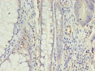 Immunofluorescent analysis of A431 cells using CAC08237 at dilution of 1:100 and Alexa Fluor 488-congugated AffiniPure Goat Anti-Rabbit IgG(H+L)