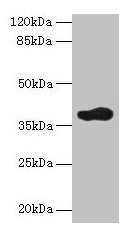 Immunohistochemistry of paraffin-embedded human breast cancer using CAC08241 at dilution of 1:100