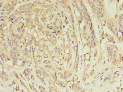 Immunohistochemistry of paraffin-embedded human liver tissue using CAC08241 at dilution of 1:100