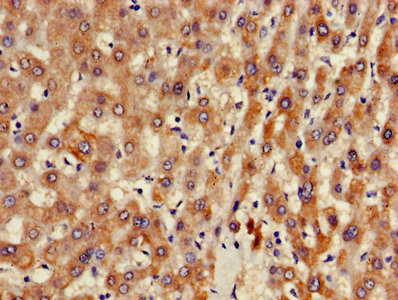 Immunofluorescence staining of Hela cells with CAC08241 at 1:120,counter-stained with DAPI. The cells were fixed in 4% formaldehyde, permeabilized using 0.2% Triton X-100 and blocked in 10% normal Goat Serum. The cells were then incubated with the antibody overnight at 4°C.The secondary antibody was Alexa Fluor 488-congugated AffiniPure Goat Anti-Rabbit IgG (H+L).