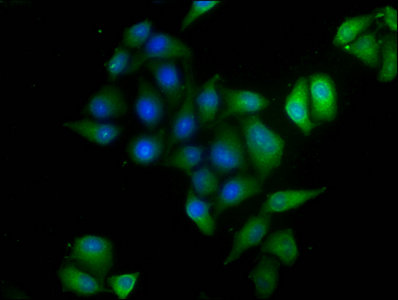 Arfip2 Polyclonal Antibody - image 5