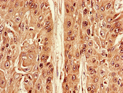 Immunofluorescent analysis of U251 cells using CAC08251 at dilution of 1:100 and Alexa Fluor 488-congugated AffiniPure Goat Anti-Rabbit IgG(H+L)