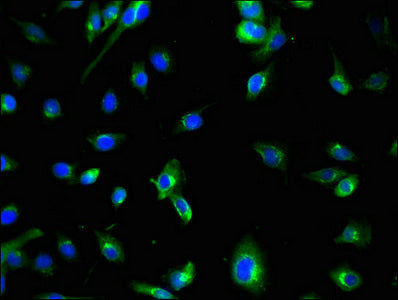 Western Blot; , Positive WB detected in: HEK293 whole cell lysate; , All lanes: ATG7 antibody at 3.5µg/ml; , Secondary; , Goat polyclonal to rabbit IgG at 1/50000 dilution; , Predicted band size: 78, 76, 69 kDa; , Observed band size: 78 kDa