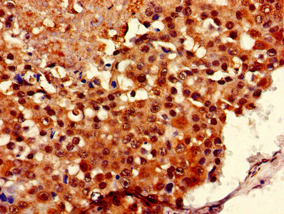 Immunofluorescent analysis of U251 cells using CAC08274 at dilution of 1:100 and Alexa Fluor 488-congugated AffiniPure Goat Anti-Rabbit IgG(H+L)