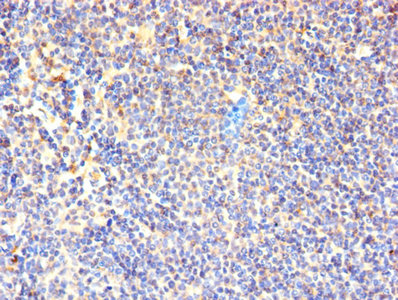Immunohistochemistry of paraffin-embedded human tonsil tissue using CAC08296 at dilution of 1:100