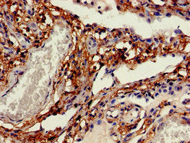 Immunofluorescent analysis of PC-3 cells using CAC08301 at dilution of 1:100 and Alexa Fluor 488-congugated AffiniPure Goat Anti-Rabbit IgG(H+L)