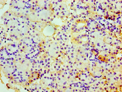 Immunohistochemistry of paraffin-embedded human small intestine tissue using CAC08310 at dilution of 1:100