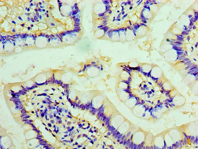 Chga Polyclonal Antibody - image 3