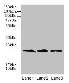 Immunofluorescent analysis of HepG2 cells using CAC08316 at dilution of 1:100 and Alexa Fluor 488-congugated AffiniPure Goat Anti-Rabbit IgG(H+L)