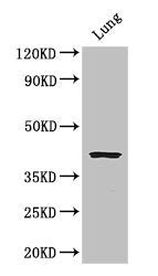 Immunohistochemistry of paraffin-embedded human melanoma using CAC08351 at dilution of 1:100