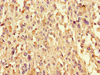 Immunofluorescent analysis of A375 cells using CAC08351 at dilution of 1:100 and Alexa Fluor 488-congugated AffiniPure Goat Anti-Rabbit IgG(H+L)
