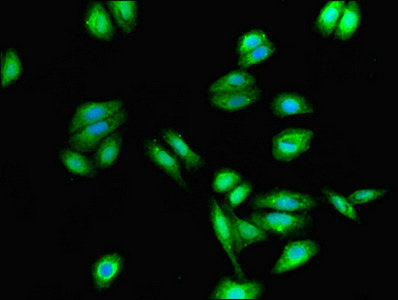 Cysltr1 Polyclonal Antibody - image 5