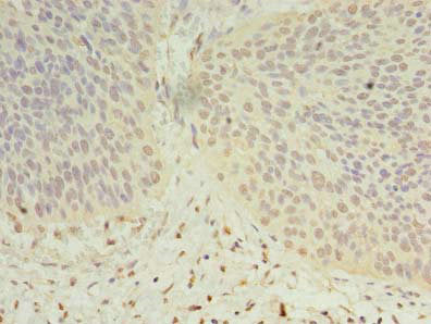 Immunofluorescent analysis of MCF-7 cells using CAC08360 at dilution of 1:100 and Alexa Fluor 488-congugated AffiniPure Goat Anti-Rabbit IgG(H+L)
