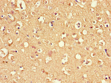 Immunohistochemistry of paraffin-embedded human skin tissue using CAC08369 at dilution of 1:100