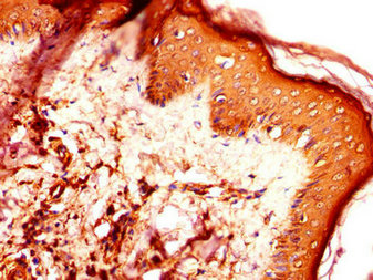 Immunofluorescent analysis of Hela cells using CAC08369 at dilution of 1:100 and Alexa Fluor 488-congugated AffiniPure Goat Anti-Rabbit IgG(H+L)