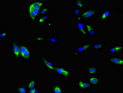 Dnajc6 Polyclonal Antibody - image 4