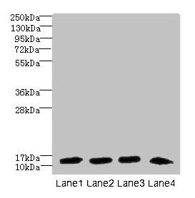 Immunohistochemistry of paraffin-embedded human testis tissue using CAC08370 at dilution of 1:100