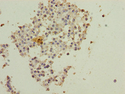 Immunofluorescent analysis of MCF-7 cells using CAC08370 at dilution of 1:100 and Alexa Fluor 488-congugated AffiniPure Goat Anti-Rabbit IgG(H+L)