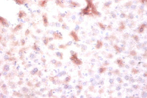 Immunofluorescent analysis of MCF-7 cells using CAC08378 at dilution of 1:100 and Alexa Fluor 488-congugated AffiniPure Goat Anti-Rabbit IgG(H+L)
