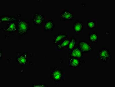 Dtwd1 Polyclonal Antibody - image 3