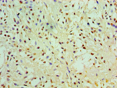 Immunofluorescent analysis of PC-3 cells using CAC08387 at dilution of 1:100 and Alexa Fluor 488-congugated AffiniPure Goat Anti-Rabbit IgG(H+L)