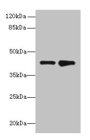Immunohistochemistry of paraffin-embedded human breast cancer using CAC08393 at dilution of 1:100