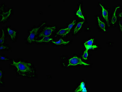 Western Blot; ,Positive WB detected in: A549 whole cell lysate; ,All lanes: F2 antibody at 3µg/ml; ,Secondary; ,Goat polyclonal to rabbit IgG at 1/50000 dilution; ,Predicted band size: 71 kDa; ,Observed band size: 71 kDa