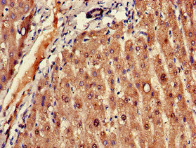 Immunohistochemistry of paraffin-embedded human heart tissue using CAC08421 at dilution of 1:100