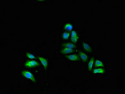 Western Blot; , Positive WB detected in: Hela whole cell lysate, SH-SY5Y whole cell lysate; , All lanes: FADS1 antibody at 3.4µg/ml; , Secondary; , Goat polyclonal to rabbit IgG at 1/50000 dilution; , Predicted band size: 52, 43 kDa; , Observed band size: 52 kDa