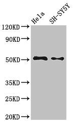 Fads1 Polyclonal Antibody - image 5